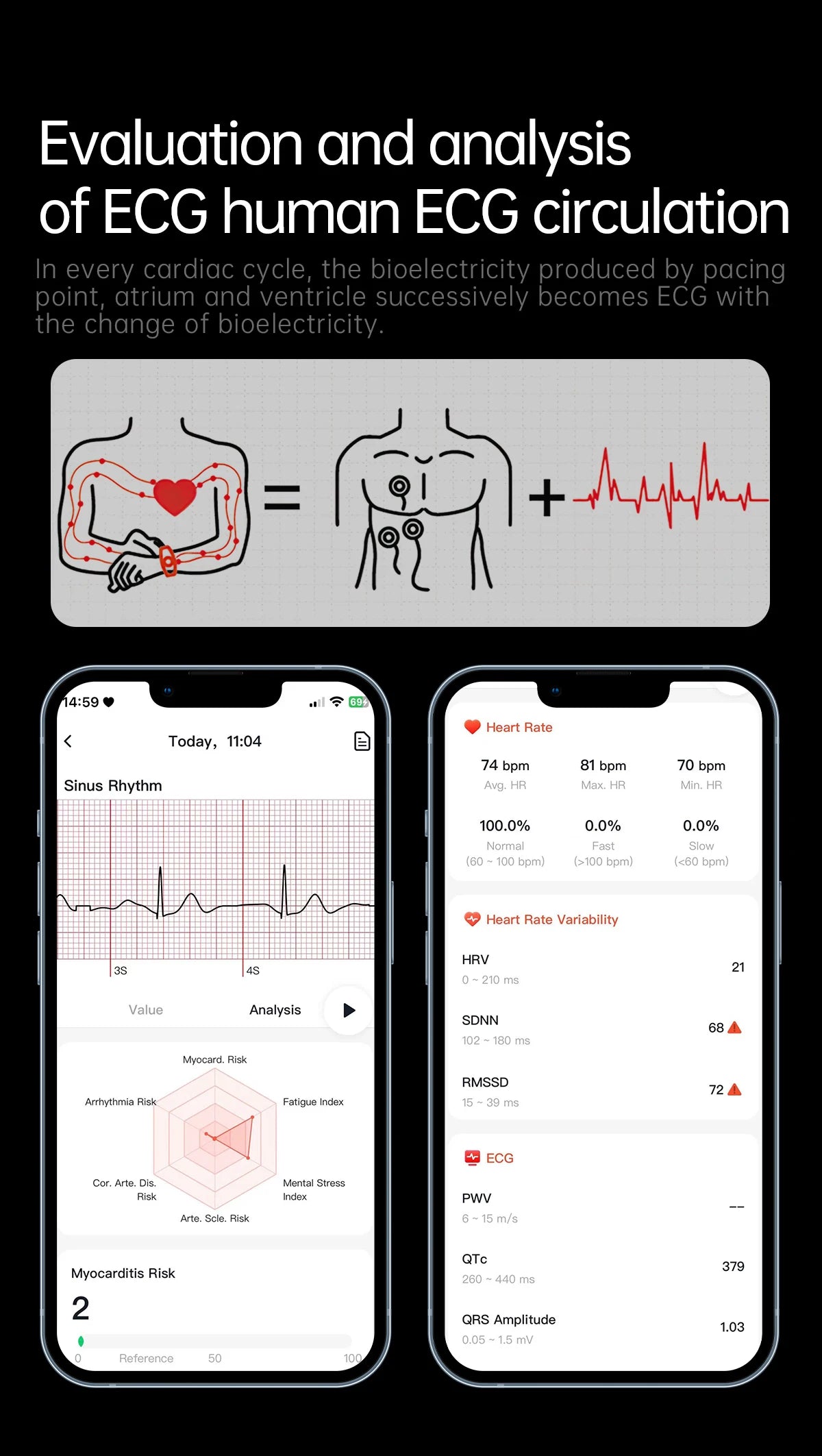 2025 New For HUAWEI Medical Grade Blood Fat Smartwatch ECG Bluetooth call Uric Acid Blood Pressure Health Monitoring Smart Watch
